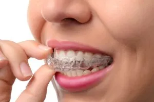 Invisalign Smile – A Holiday Gift Idea