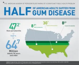 Gum Disease - Busting The Myths