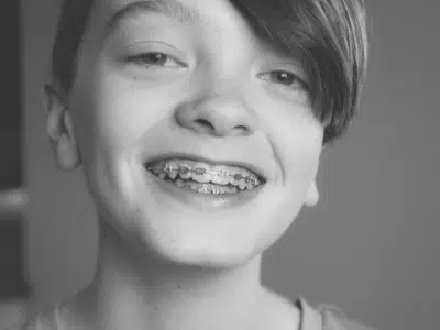 Boy showing his teeth